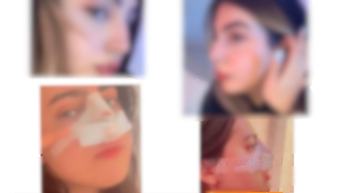 وقتی همان بینی‌های عروسکی شده را قوزدار می‌کنند