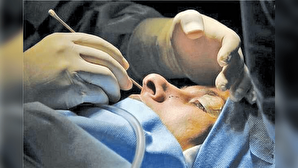 صورت‌هایی که زیر تیغِ دیپلمه‌ها زخمی می‌شود